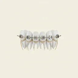 Aparat dentar
