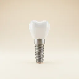 Implant dentar